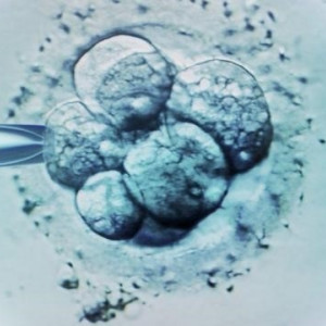 Fecundación in vitro: la controvertida decisión judicial en EEUU que considera que los embriones congelados son niños (y los efectos que está teniendo)